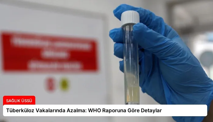 Tüberküloz Vakalarında Azalma: WHO Raporuna Göre Detaylar