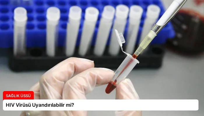 HIV Virüsü Uyandırılabilir mi?