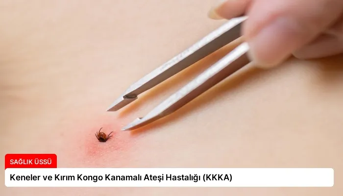 Keneler ve Kırım Kongo Kanamalı Ateşi Hastalığı (KKKA)