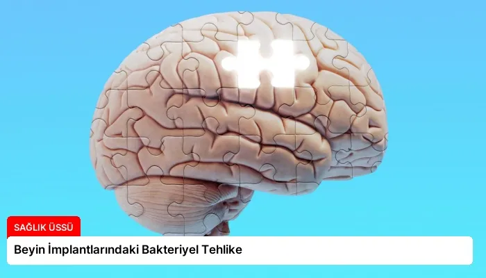 Beyin İmplantlarındaki Bakteriyel Tehlike