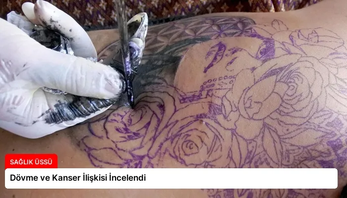 Dövme ve Kanser İlişkisi İncelendi