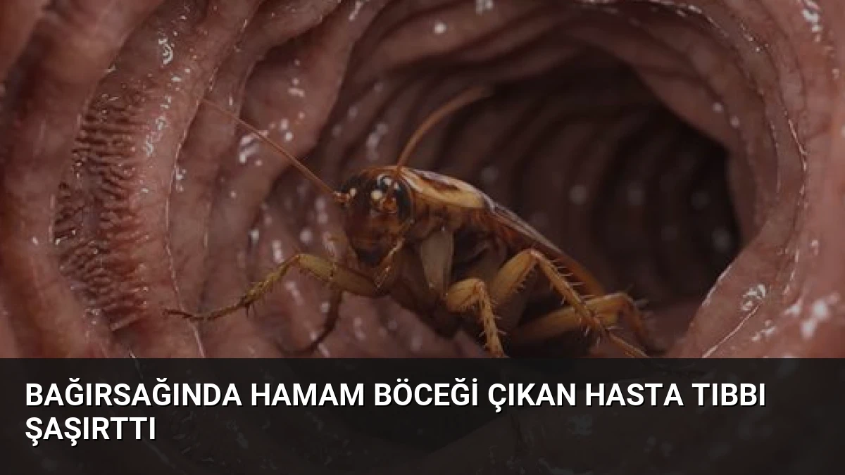 Bağırsağında Hamam Böceği Çıkan Hasta Tıbbı Şaşırttı