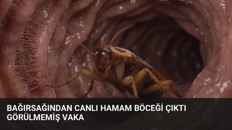 Bağırsağından Canlı Hamam Böceği Çıktı Görülmemiş Vaka