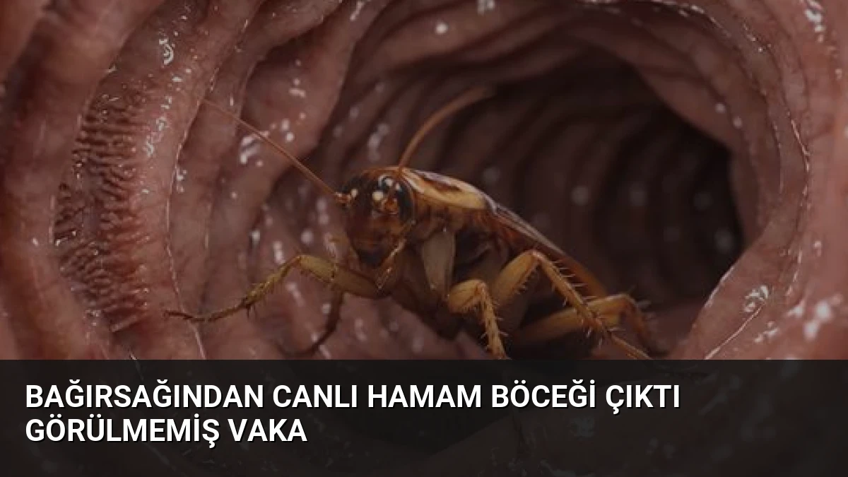 Bağırsağından Canlı Hamam Böceği Çıktı Görülmemiş Vaka