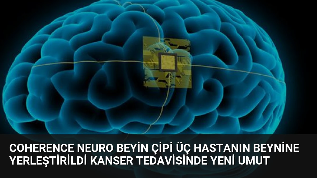 Coherence Neuro Beyin Çipi Üç Hastanın Beynine Yerleştirildi Kanser Tedavisinde Yeni Umut