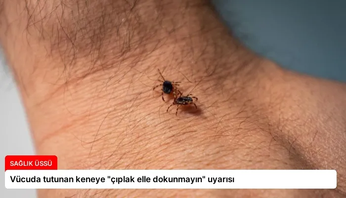 Vücuda tutunan keneye “çıplak elle dokunmayın” uyarısı