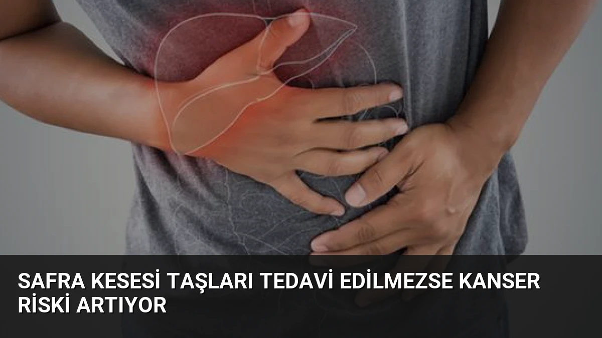 Safra Kesesi Taşları Tedavi Edilmezse Kanser Riski Artıyor