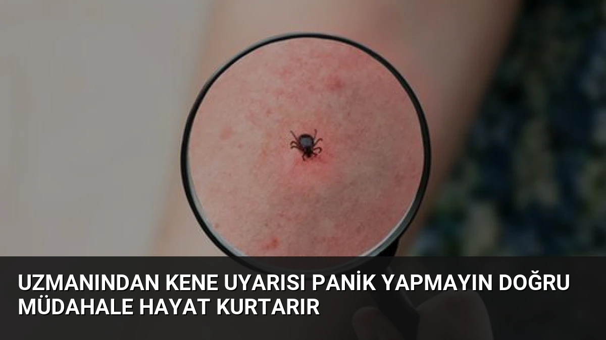 Uzmanından Kene Uyarısı Panik Yapmayın Doğru Müdahale Hayat Kurtarır