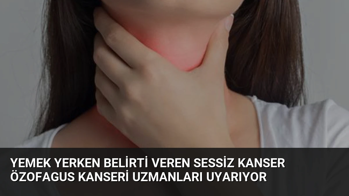 Yemek Yerken Belirti Veren Sessiz Kanser Özofagus Kanseri Uzmanları Uyarıyor