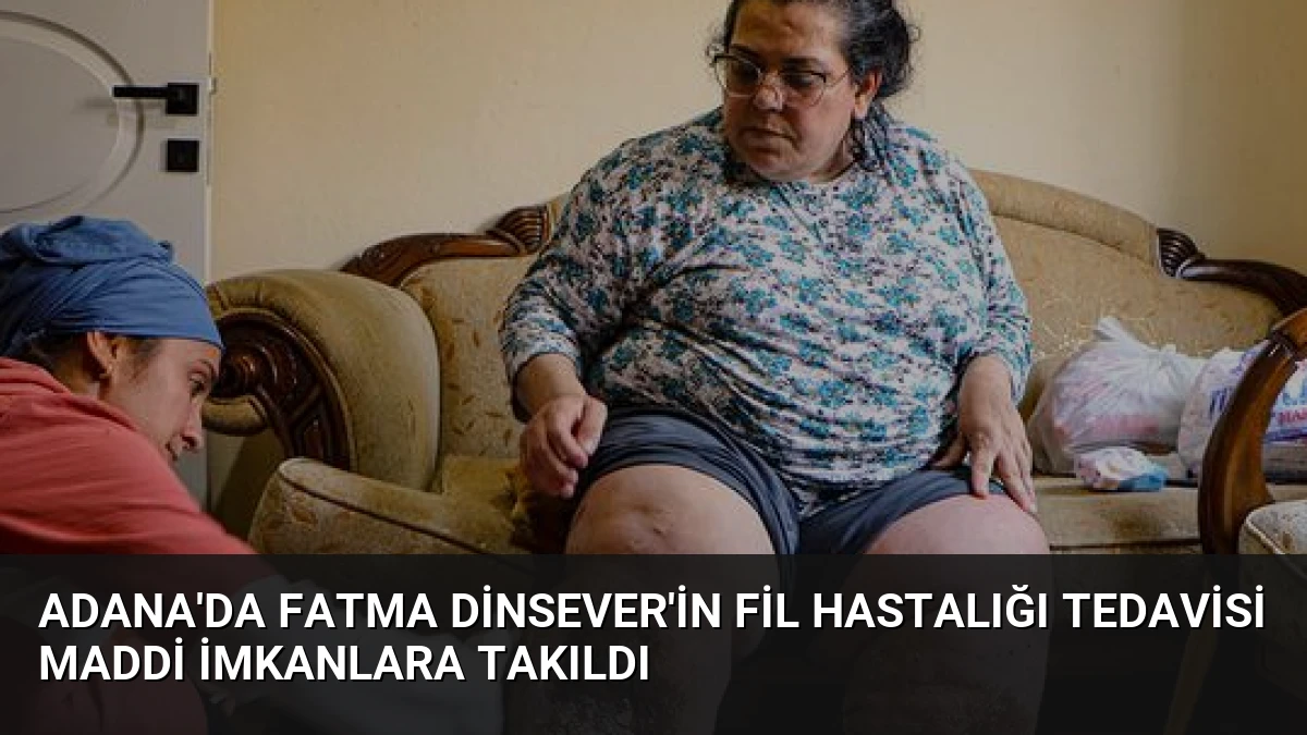 Adana’da Fatma Dinsever’in Fil Hastalığı Tedavisi Maddi İmkanlara Takıldı