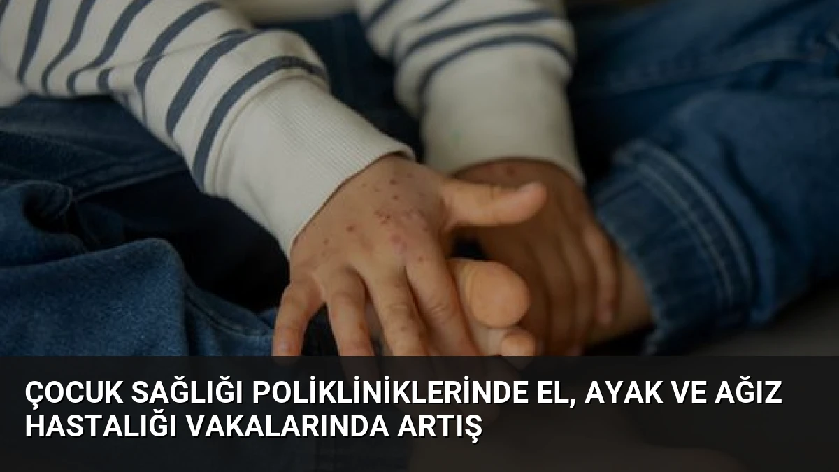 Çocuk Sağlığı Polikliniklerinde El, Ayak ve Ağız Hastalığı Vakalarında Artış