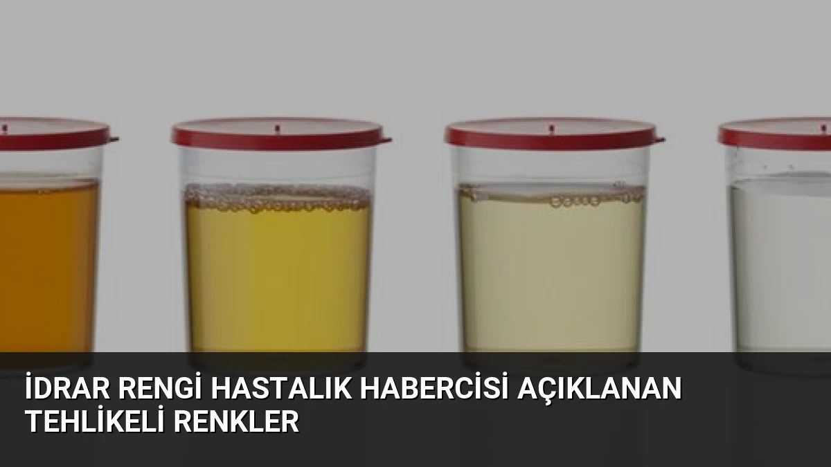 İdrar Rengi Hastalık Habercisi Açıklanan Tehlikeli Renkler