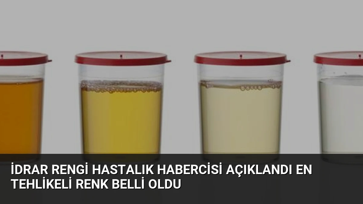 İdrar Rengi Hastalık Habercisi Açıklandı En Tehlikeli Renk Belli Oldu