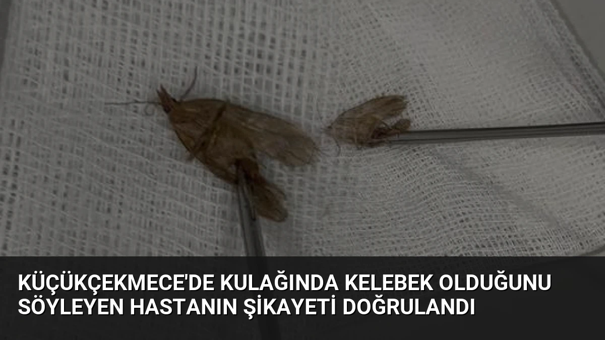 Küçükçekmece’de Kulağında Kelebek Olduğunu Söyleyen Hastanın Şikayeti Doğrulandı
