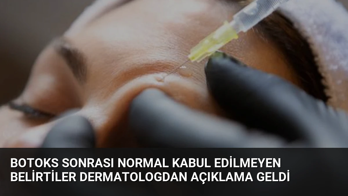 Botoks Sonrası Normal Kabul Edilmeyen Belirtiler Dermatologdan Açıklama Geldi