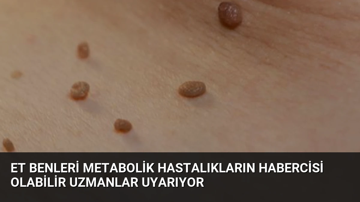 Et Benleri Metabolik Hastalıkların Habercisi Olabilir Uzmanlar Uyarıyor