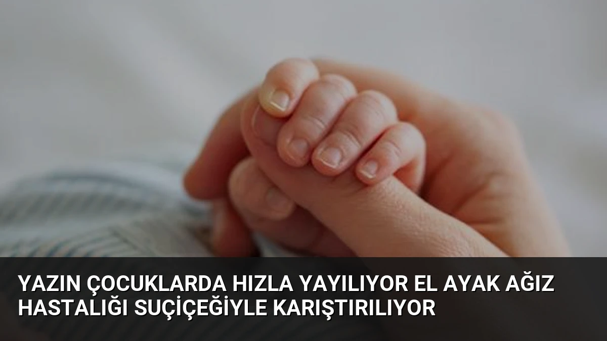 Yazın Çocuklarda Hızla Yayılıyor El Ayak Ağız Hastalığı Suçiçeğiyle Karıştırılıyor