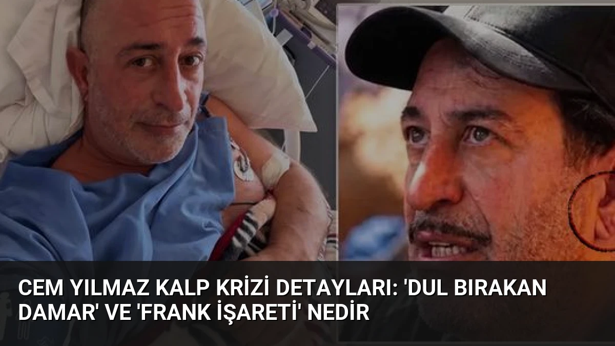 Cem Yılmaz Kalp Krizi Detayları: ‘Dul Bırakan Damar’ ve ‘Frank İşareti’ Nedir