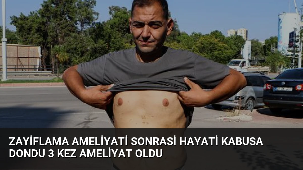 Zayiflama Ameliyati Sonrasi Hayati Kabusa Dondu 3 Kez Ameliyat Oldu