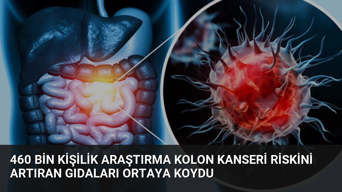 460 Bin Kişilik Araştırma Kolon Kanseri Riskini Artıran Gıdaları Ortaya Koydu