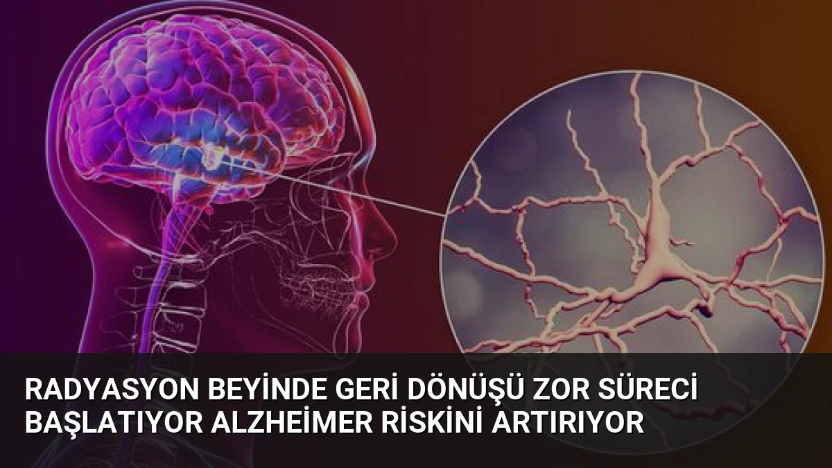 Radyasyon Beyinde Geri Dönüşü Zor Süreci Başlatıyor Alzheimer Riskini Artırıyor