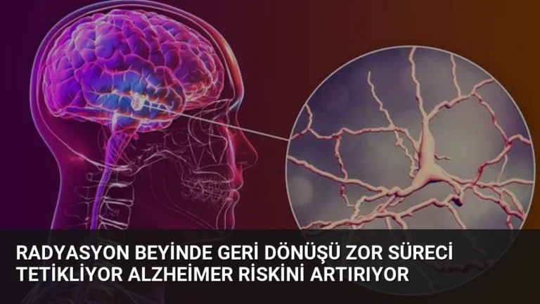 Radyasyon Beyinde Geri Dönüşü Zor Süreci Tetikliyor Alzheimer Riskini Artırıyor